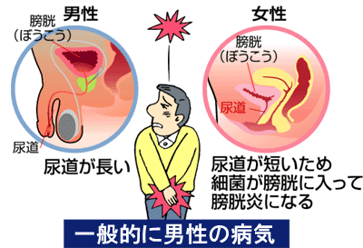 尿道炎の症状 原因について 公式 横幕鍼灸院