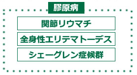 疲れる シェーグレン 症候群