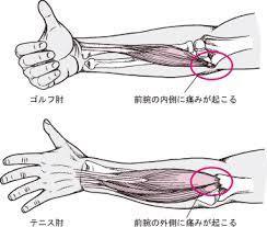 肘 の 内側